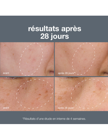 Powerbright dark spot system