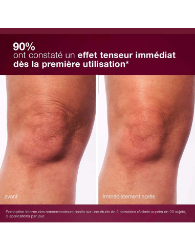 Dynamic skin sculptor