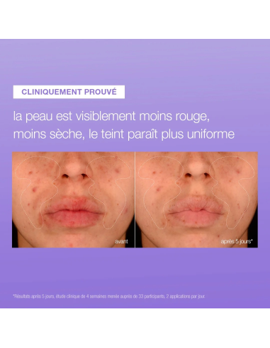 Stabilizing repair serum
