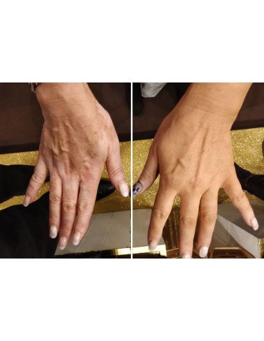 SprayFond Express 150ml SprayFond Express 150ml