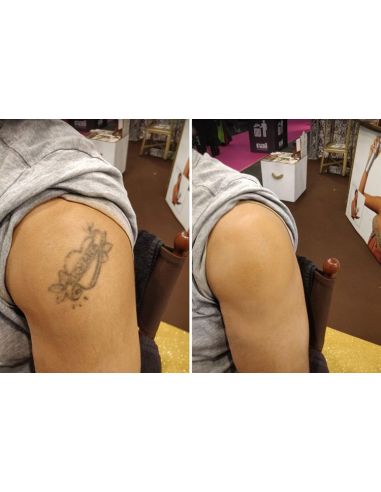 SprayFond Express 150ml SprayFond Express 150ml